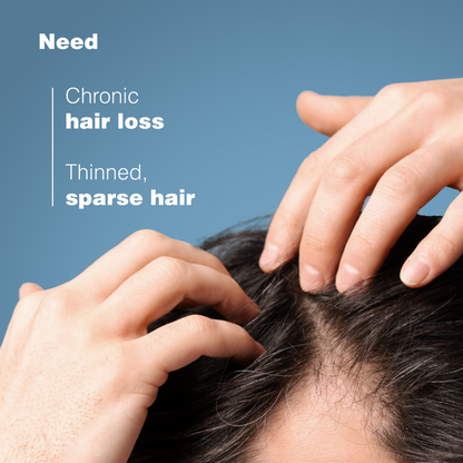 Ducray Anaphase Anti-Hair Loss Shampoo 6.76 fl oz