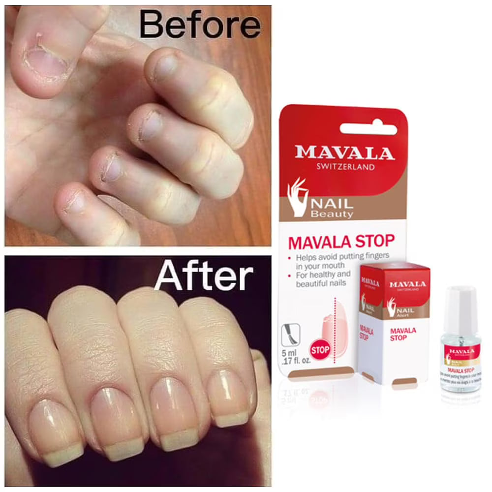 Mavala Stop Nail Biting Deterrent – 0.34 fl oz